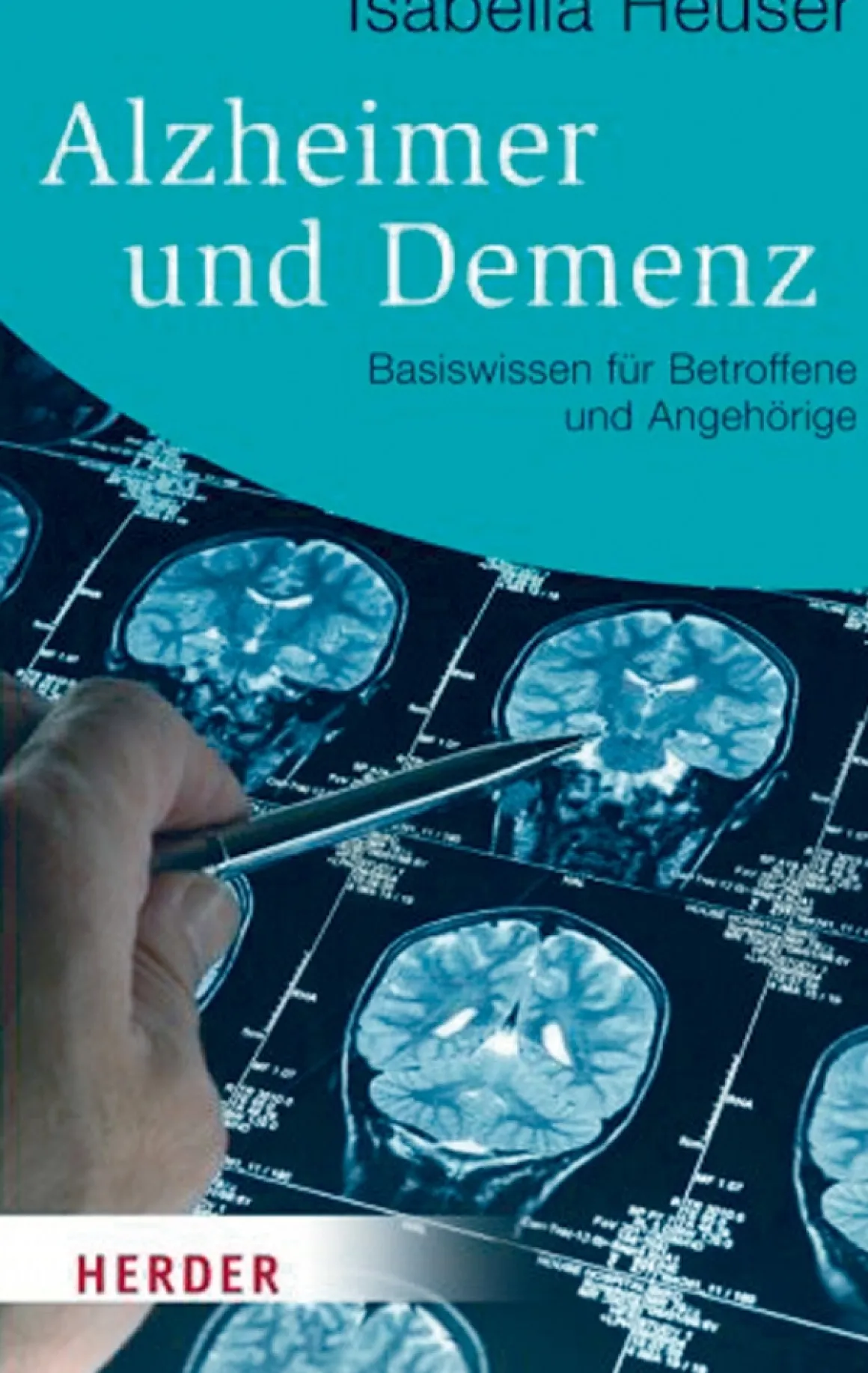 Alzheimer und Demenz
